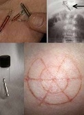Impacts sur l'humains image